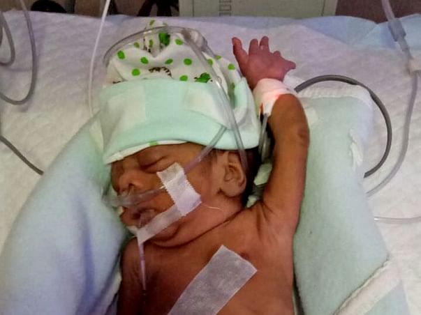 Help Premature Baby of Shihab Survive.