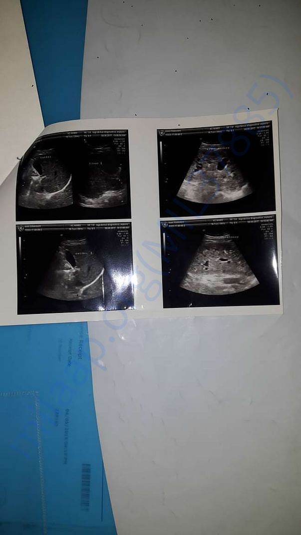 Scanning report