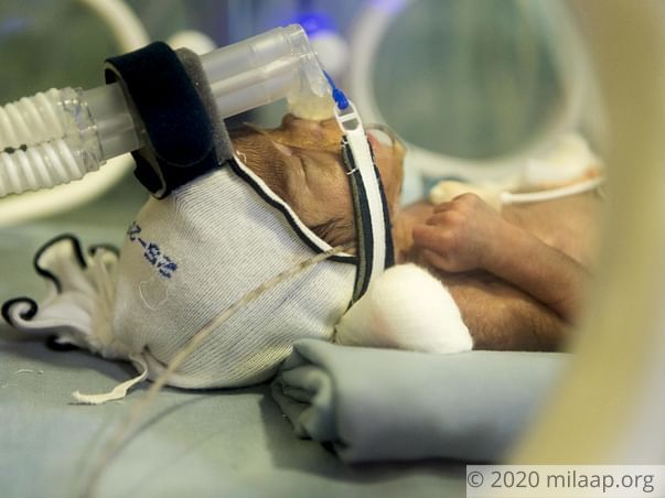 New Mother Has Not Seen Her 2-Month-Preemie Son As He Is In The ICU