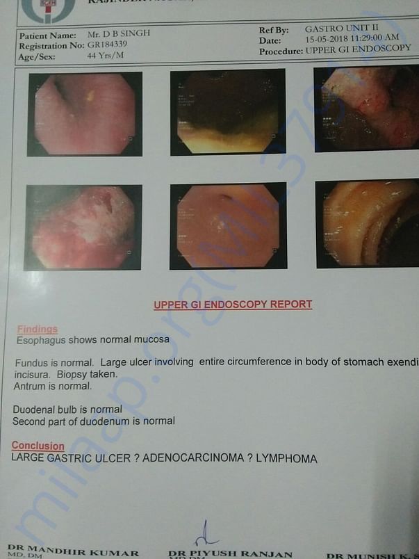 Ultrasound report