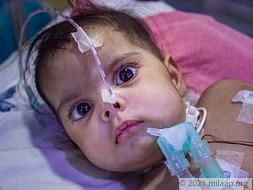 Teacher Struggles To Save His 6-month-old Baby From Lung Infection