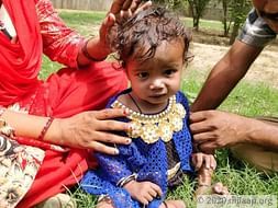 1-Year-Old Baby Disha's Failing Heart Has Almost Killed Her Twice