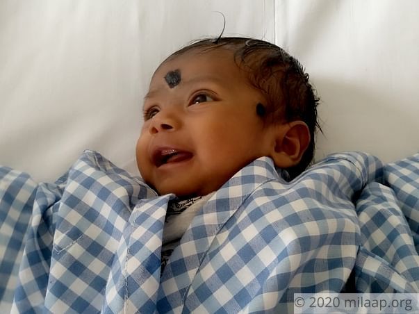 Save This 2-month-old Baby Who Has 2 Large Holes In Her Heart