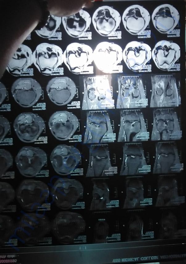 X-ray