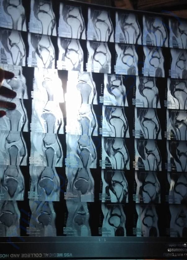 X-ray