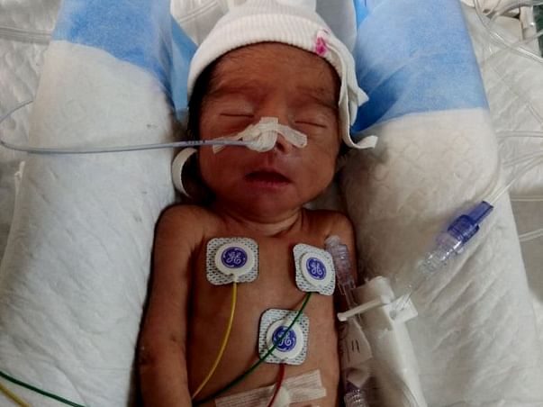 Help Baby Of Priya, Who was Born Premature And Is InNICU.