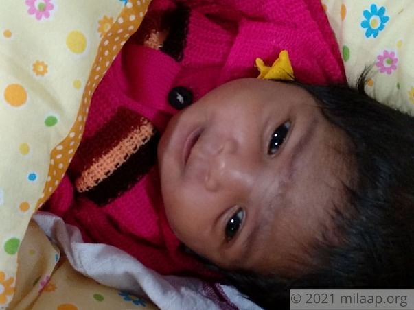 Baby Born Without Major Valve In Heart Is Gasping For Every Breath