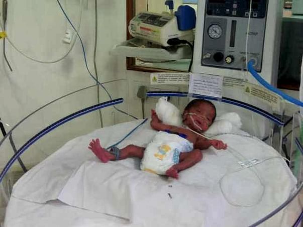 New Mother Goes Hungry Most Of The Time To Save Premature Twins