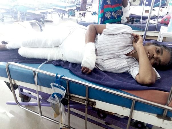 "Help Swarna fire accident" - She needs funds for medical expenses