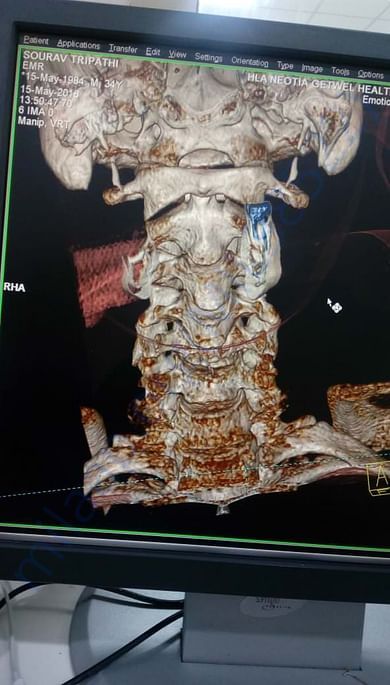 Spine MRI Report and Injury