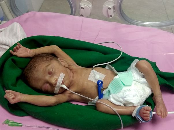 Help Female Baby of Rani & Gorakh Mawurya