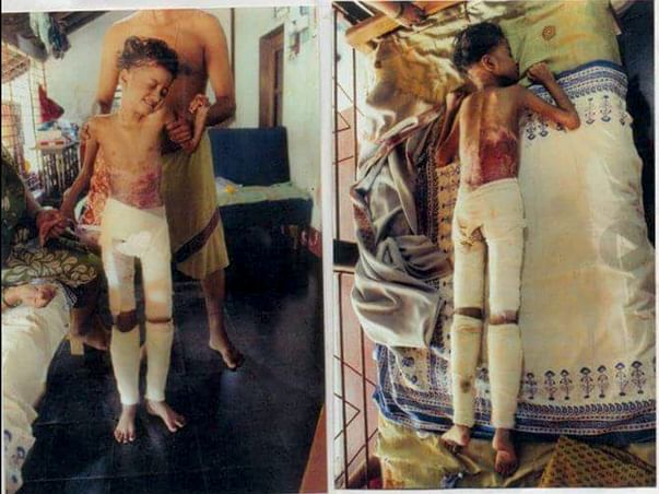 Help 10 year old Shreya to treatment