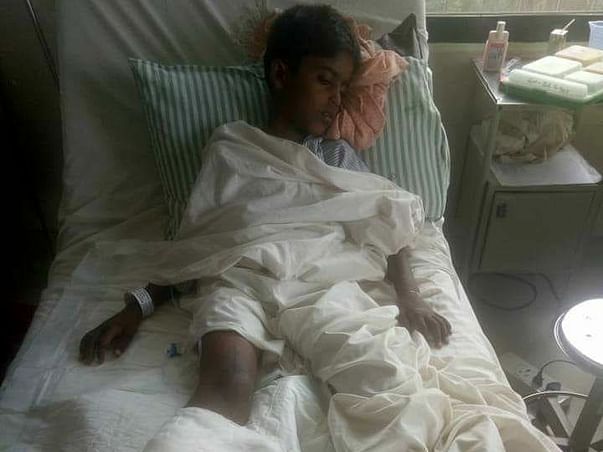 surgery for Jashwant