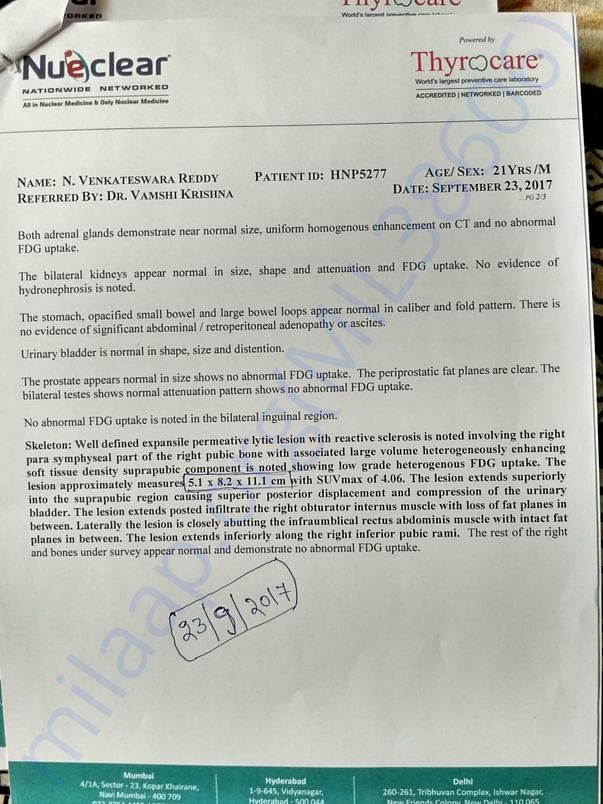 PET CAT scan report