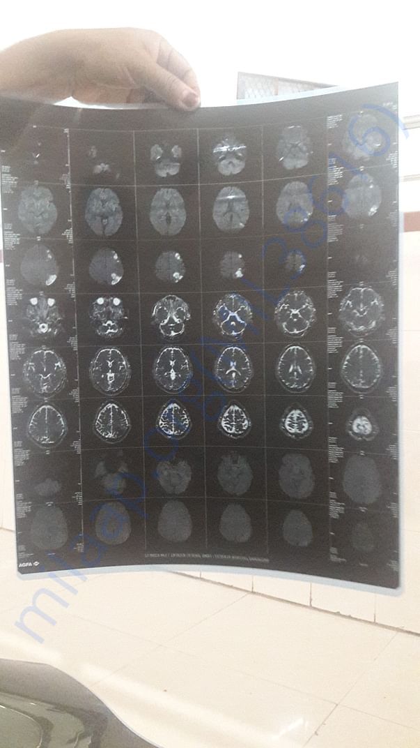 MRI scan