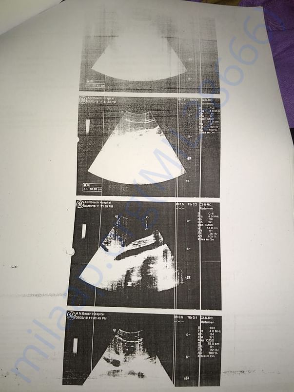 Scan