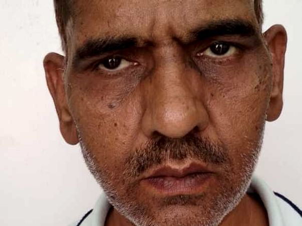 Help Yashwant Dangi Undergo A Liver Surgery