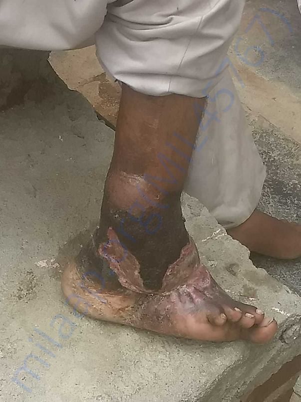 Photo of his leg