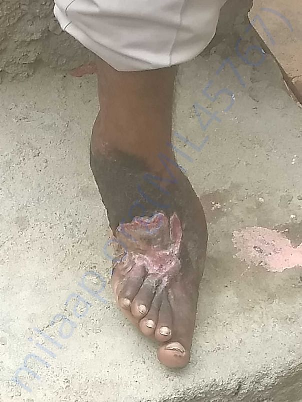 Photo of his leg
