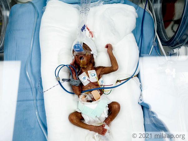 Help this first-time parents save their premature baby boy