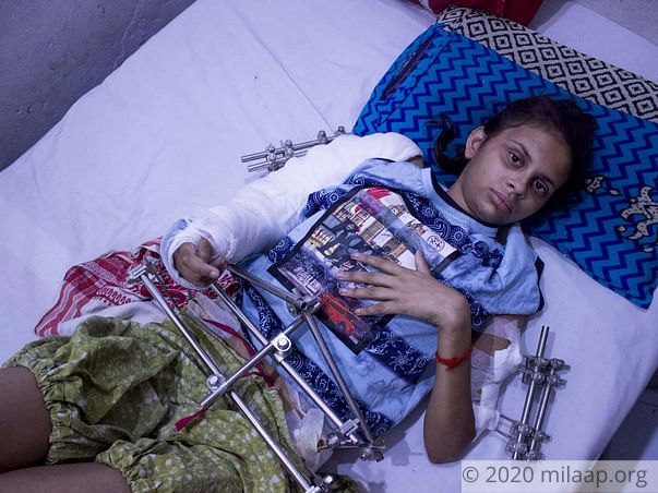 After Falling From The Third Floor,15-year-old has Multiple Fractures
