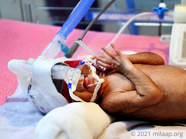 Help Kamala and Kallan save their premature twins