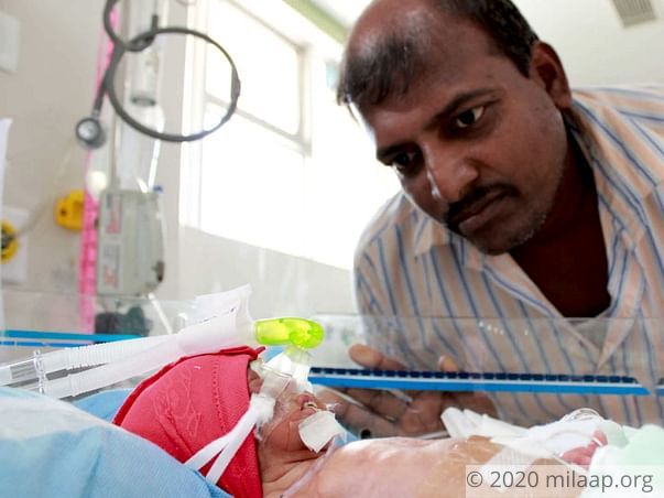 7-Day-Old Twins Need Help To Be Able To Breathe On Their Own And Live