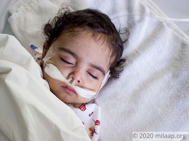 8-month-old Mudit needs a liver transplant to survive
