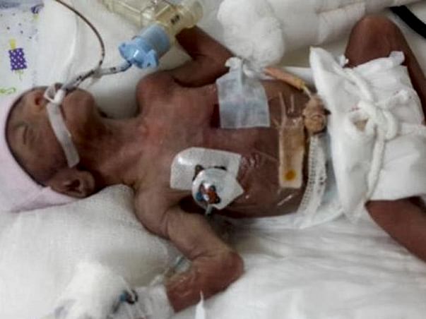 Help The Parents Save Their Young Lakshmi
