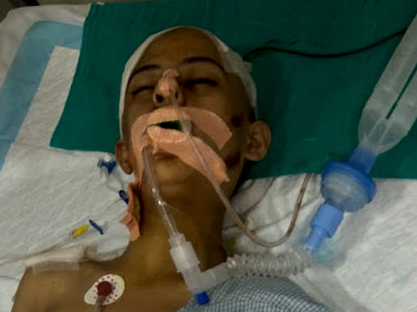 Help Lakshita Fighting For Her Life Due To A Major Road Accident.