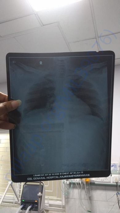 X ray