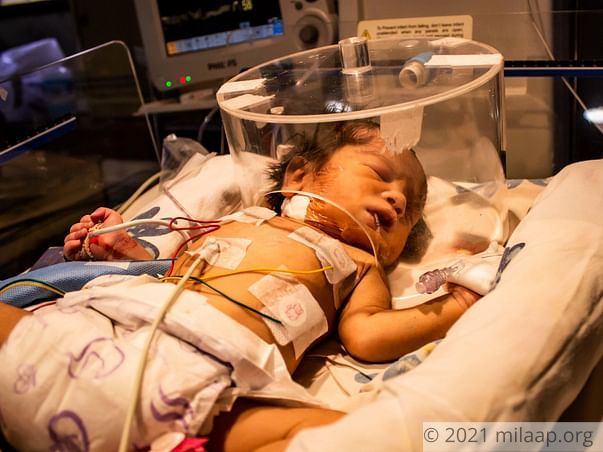This 2-day-old's Intestines Are Pushing Into His Heart and Lungs