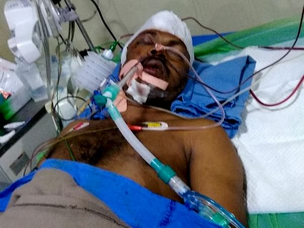 Help My Brother Who Is Undergoing For Brain Treatment
