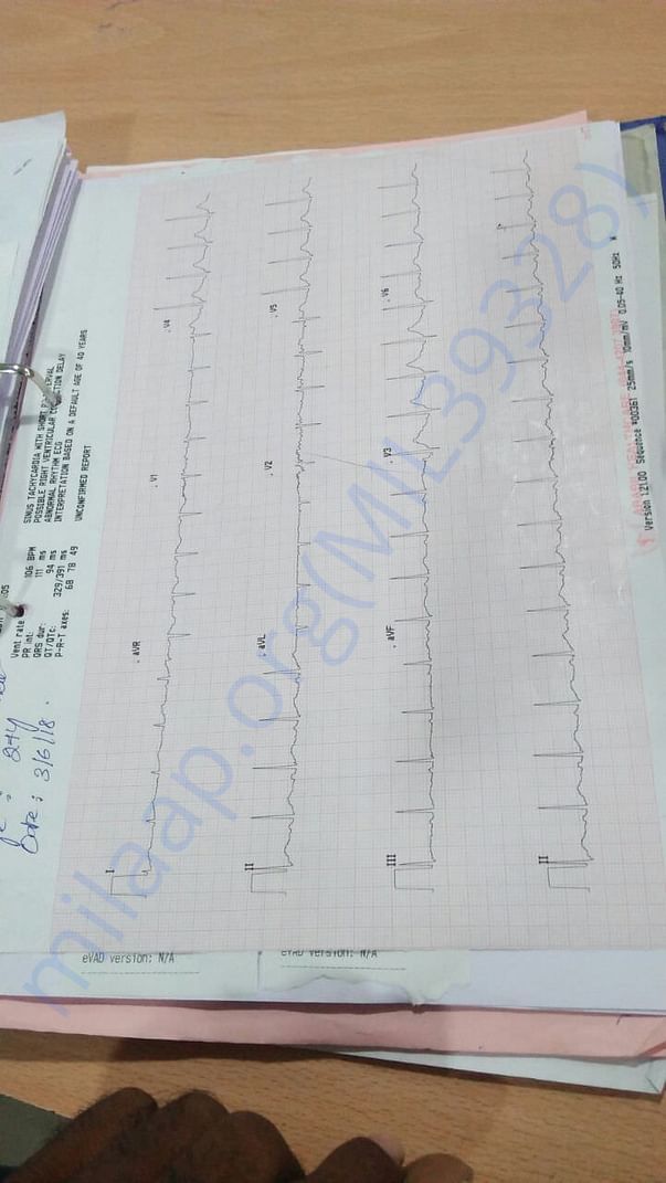 ECG reports