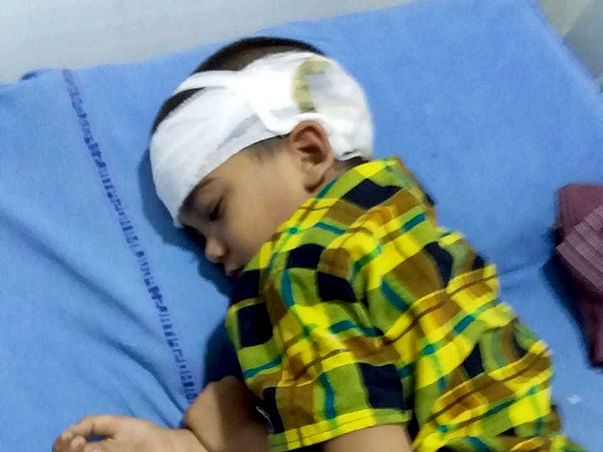 Help mahesh for brain surgery