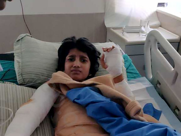 Help Sri Nithya Suffering From Severe Burn Injuries.