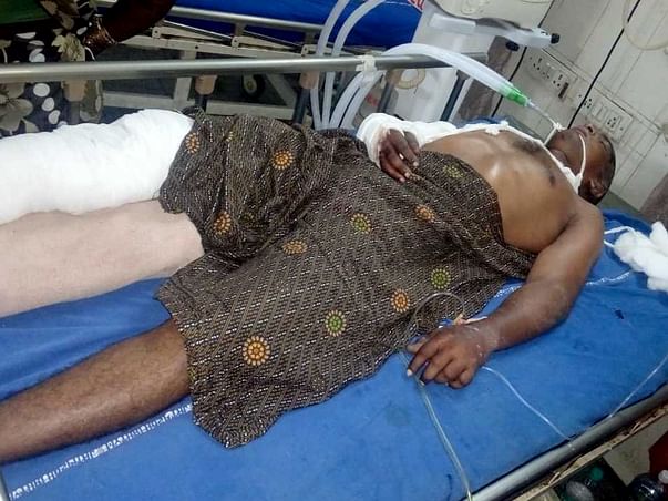Help Anjali And Her Family For Survival And Education