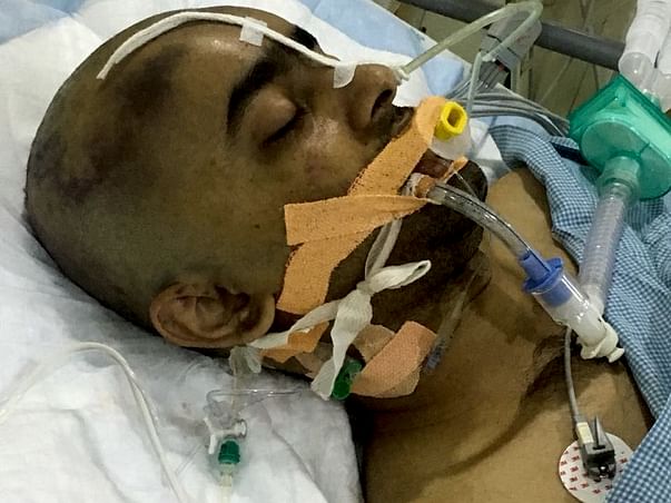 Please Help Our Friend Prashant Who Is Pushing His Limits To Survive
