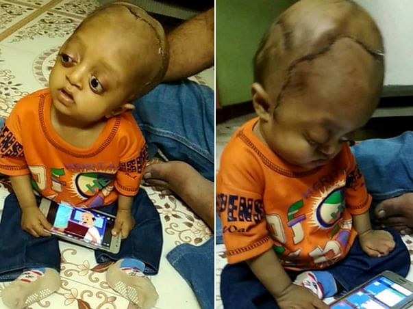 Help Ibrahim Lead A Normal Life