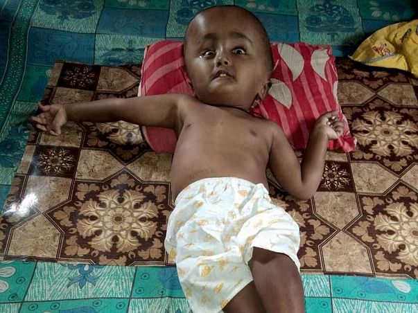 Help Aryan Fight Hydrocephalus