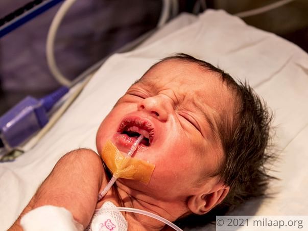 3-Day-Old Baby Born Without A Food Pipe Is Starving And Needs Surgery
