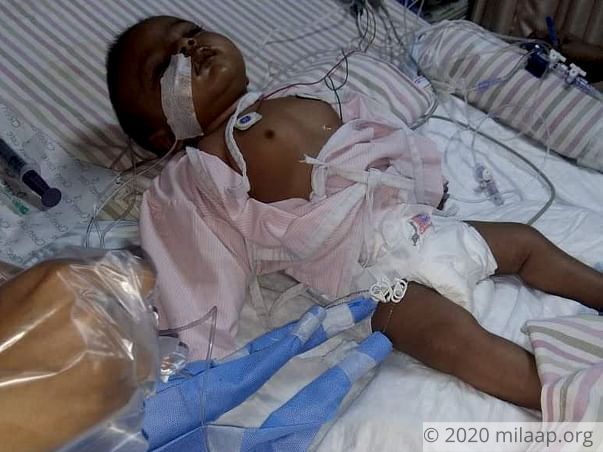 1-Year-Old Baby Girl Needs An Urgent Liver Transplant To Survive