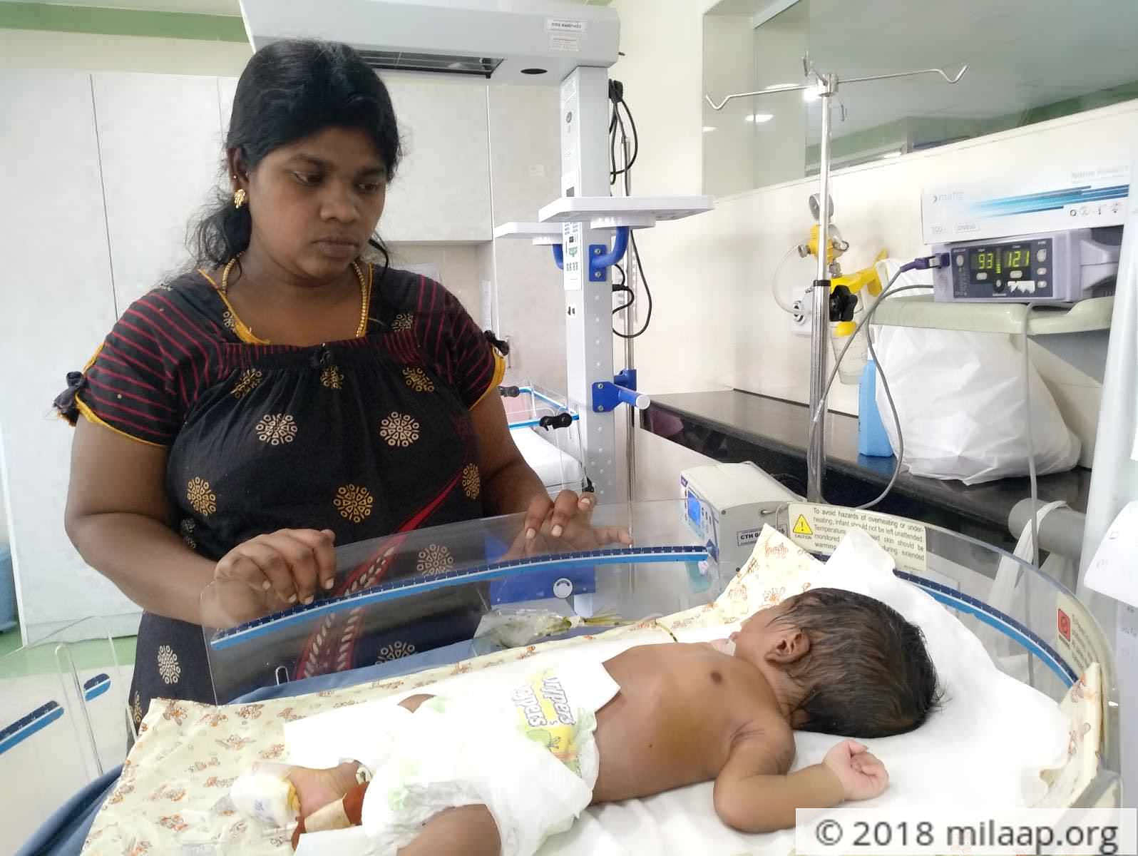 This Newborn Baby Has An External Pouch To Hold His Digested Food