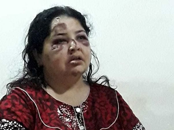 Help My Aunt Neeta Undergo An Operation