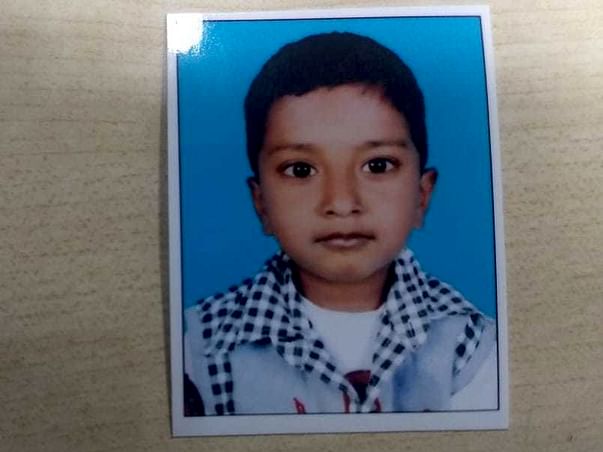 Help Akhil Survive Brain Damage