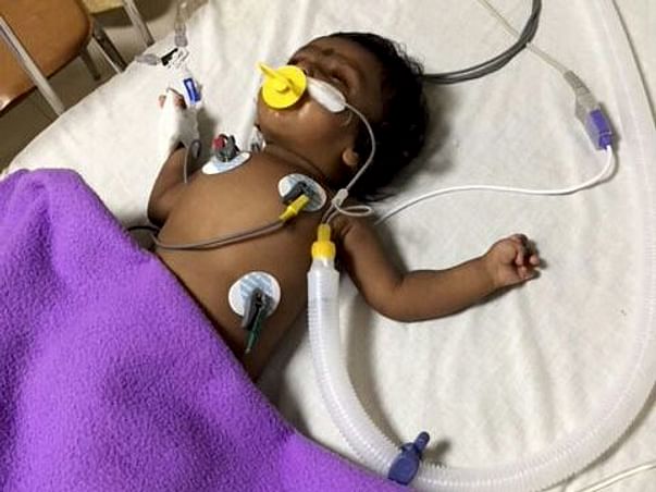 Help 3 Month Old Baby Angela For Heart Surgery