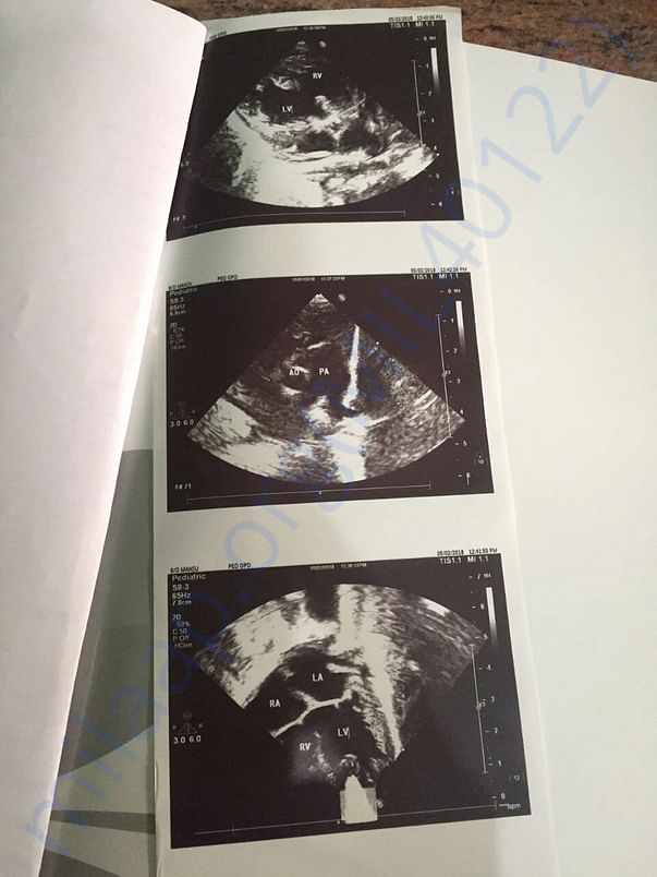 Scan Report