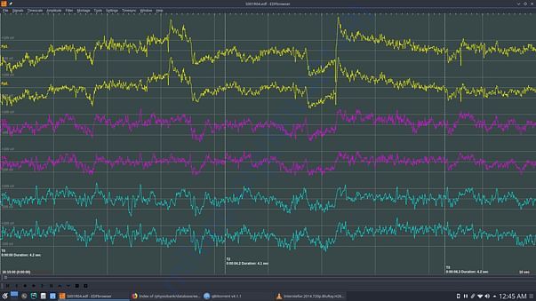 Dataset for brainwave