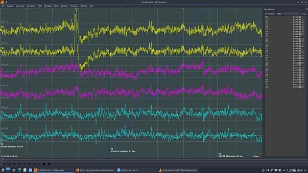 Dataset 2 for brainwaves