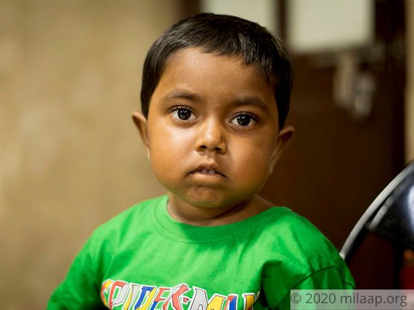 This 5-Year-Old’s Legs And Joints Are Swollen That She Can't Walk